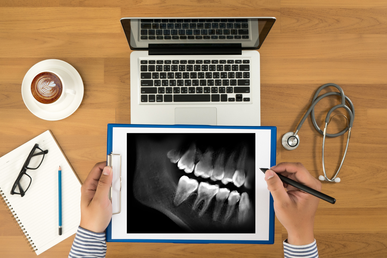 Dental x-ray