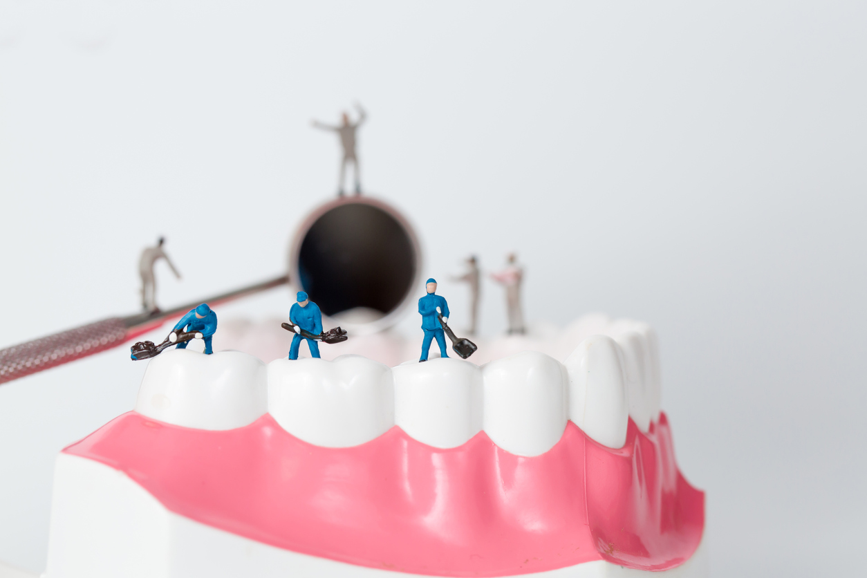 What are your options for teeth fillings?