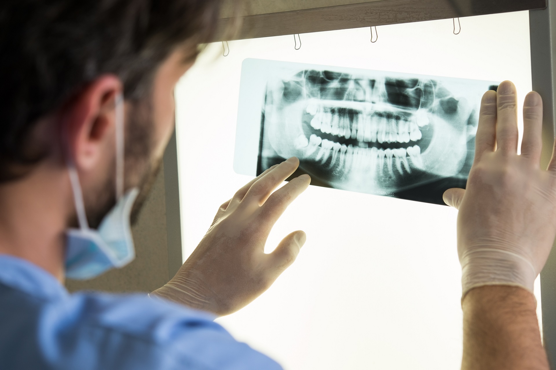 Dental x-ray