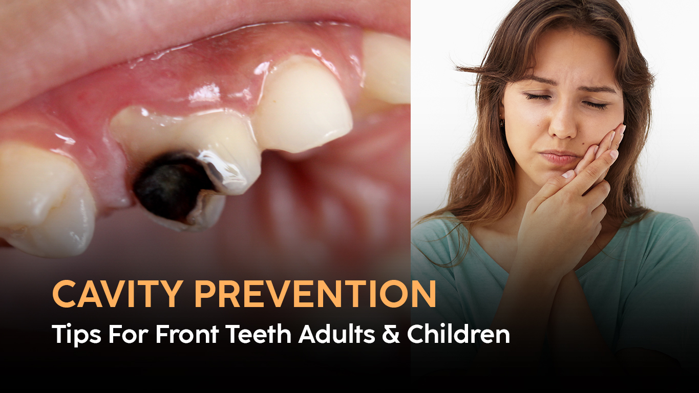 Cavity Prevention Tips