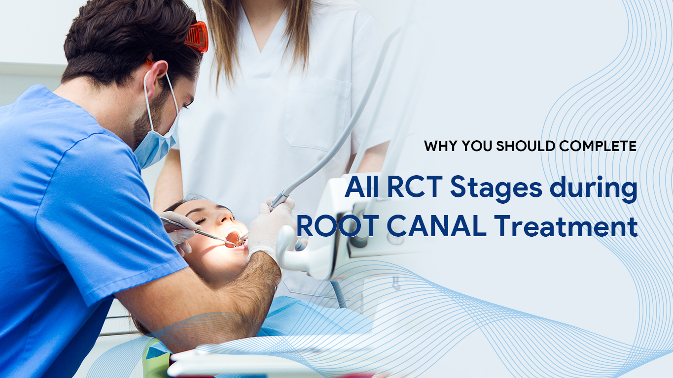 RCT Stages during Root Canal Treatment