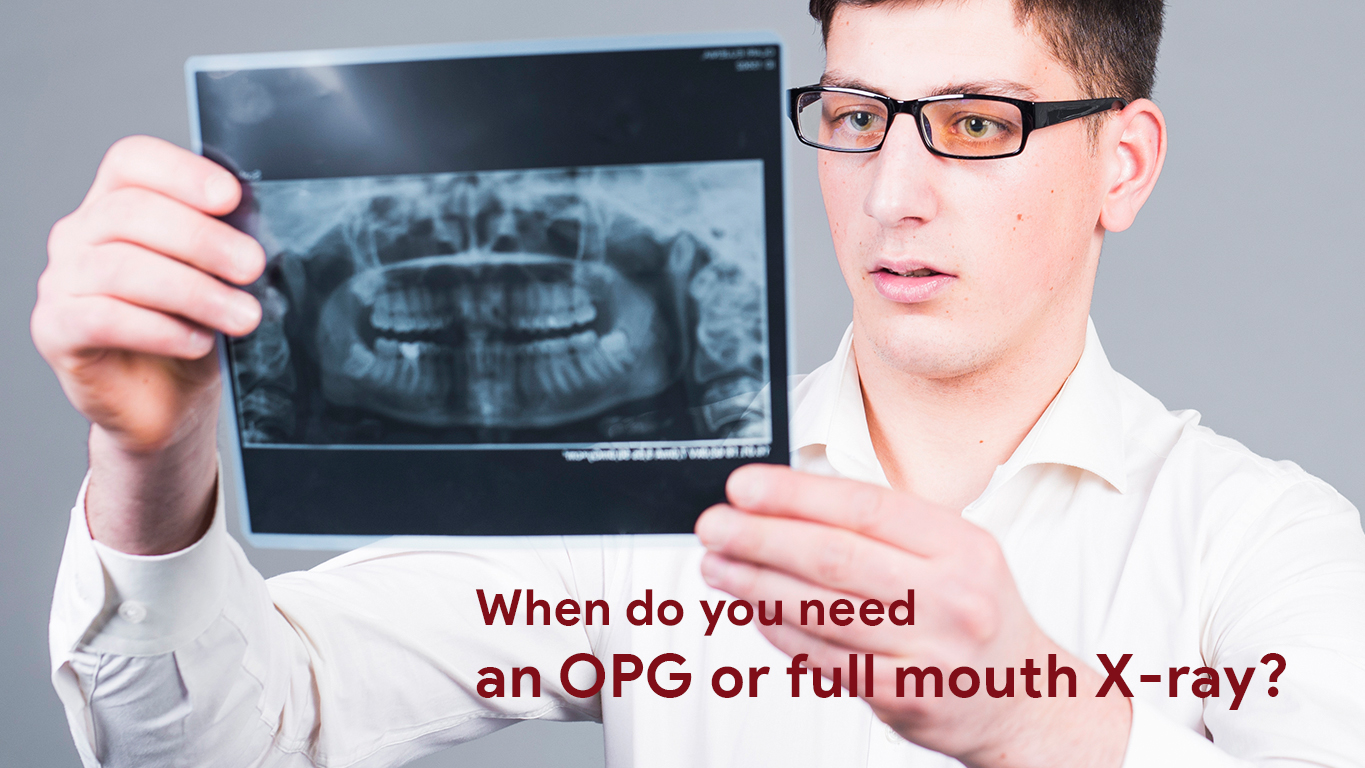 OPG & Mouth X-ray
