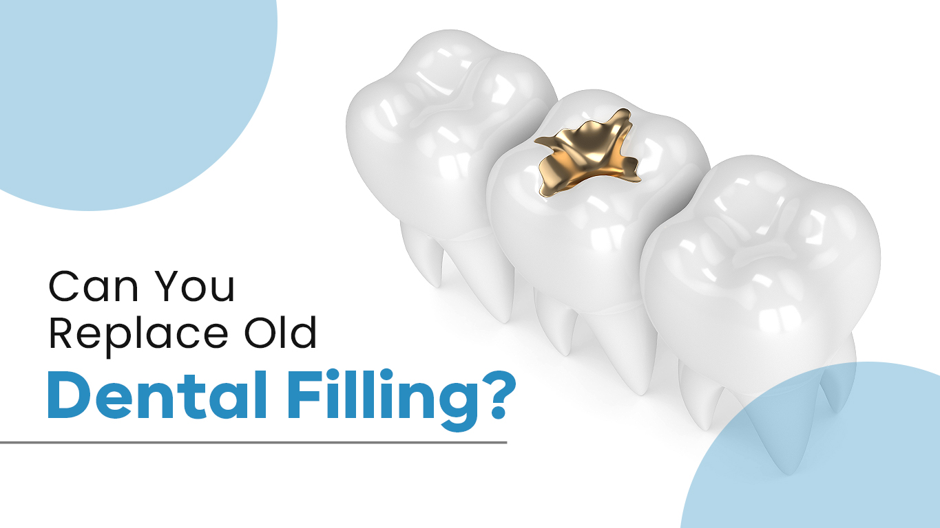 Dental Filling, Tooth Fillings Springvale