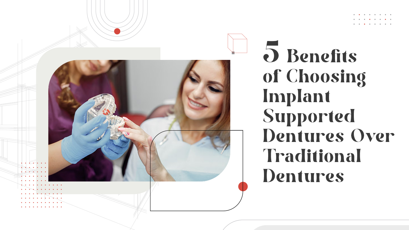 Implant Supported Dentures