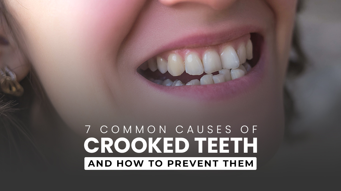 Common causes of crooked teeth