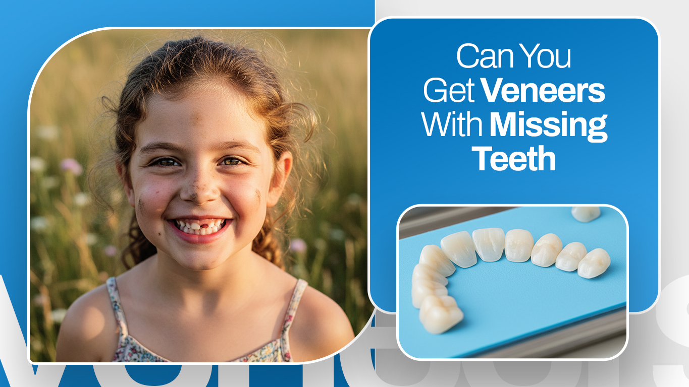 veneers with missing teeth