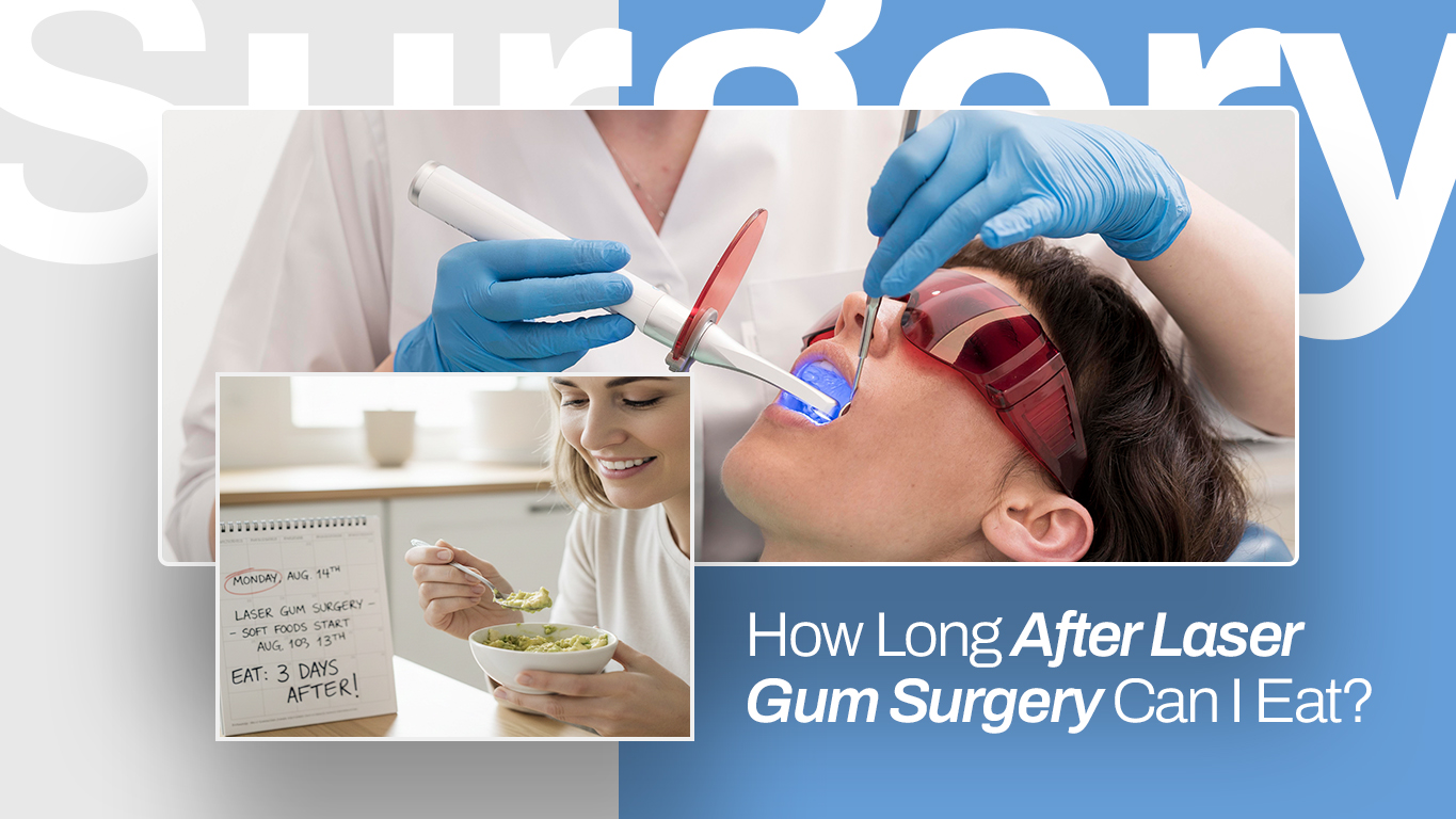 How Long After Laser Gum Surgery Can I Eat