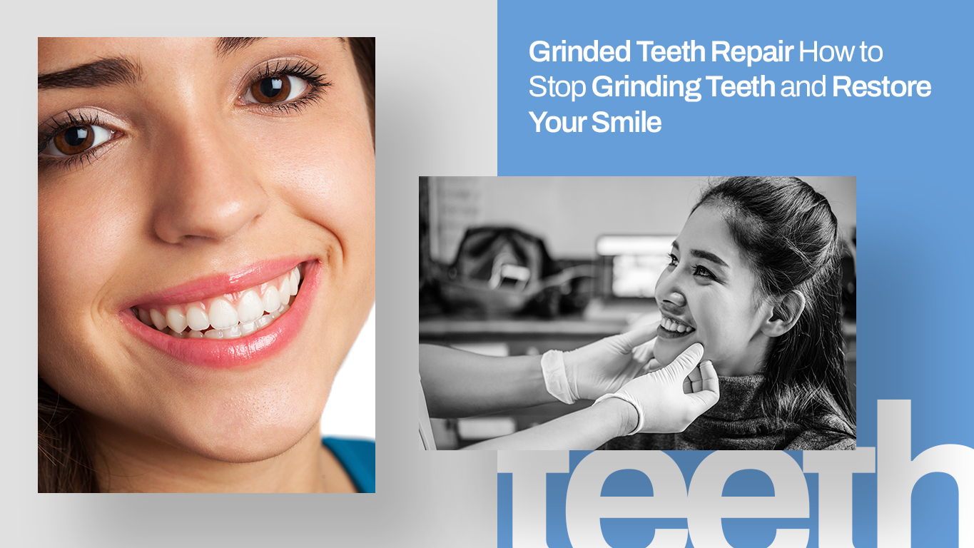 A blog feature image for grinded teeth repair