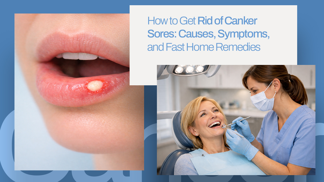 A blog featured image of How to get rid of canker sores