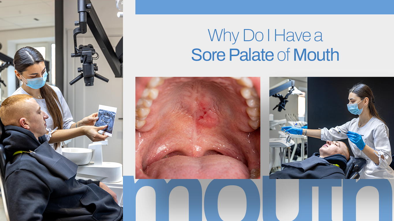 Sore Palate of mouth blog image