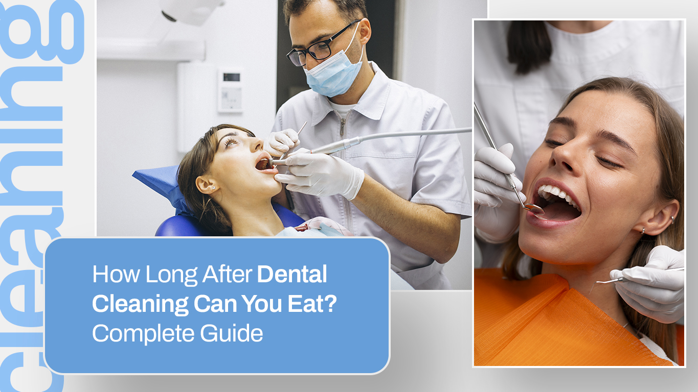 How Long After Dental Cleaning Can You Eat