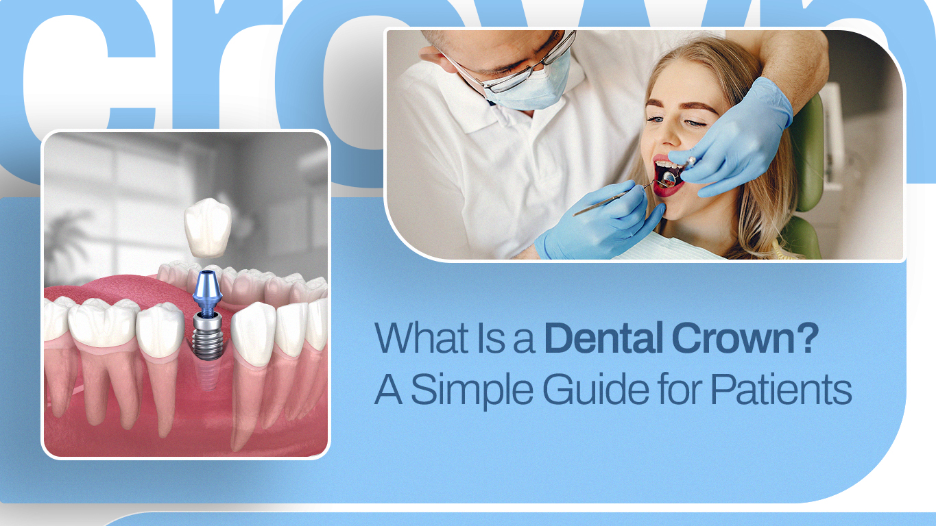 What Is a Dental Crown- A Simple Guide for Patients