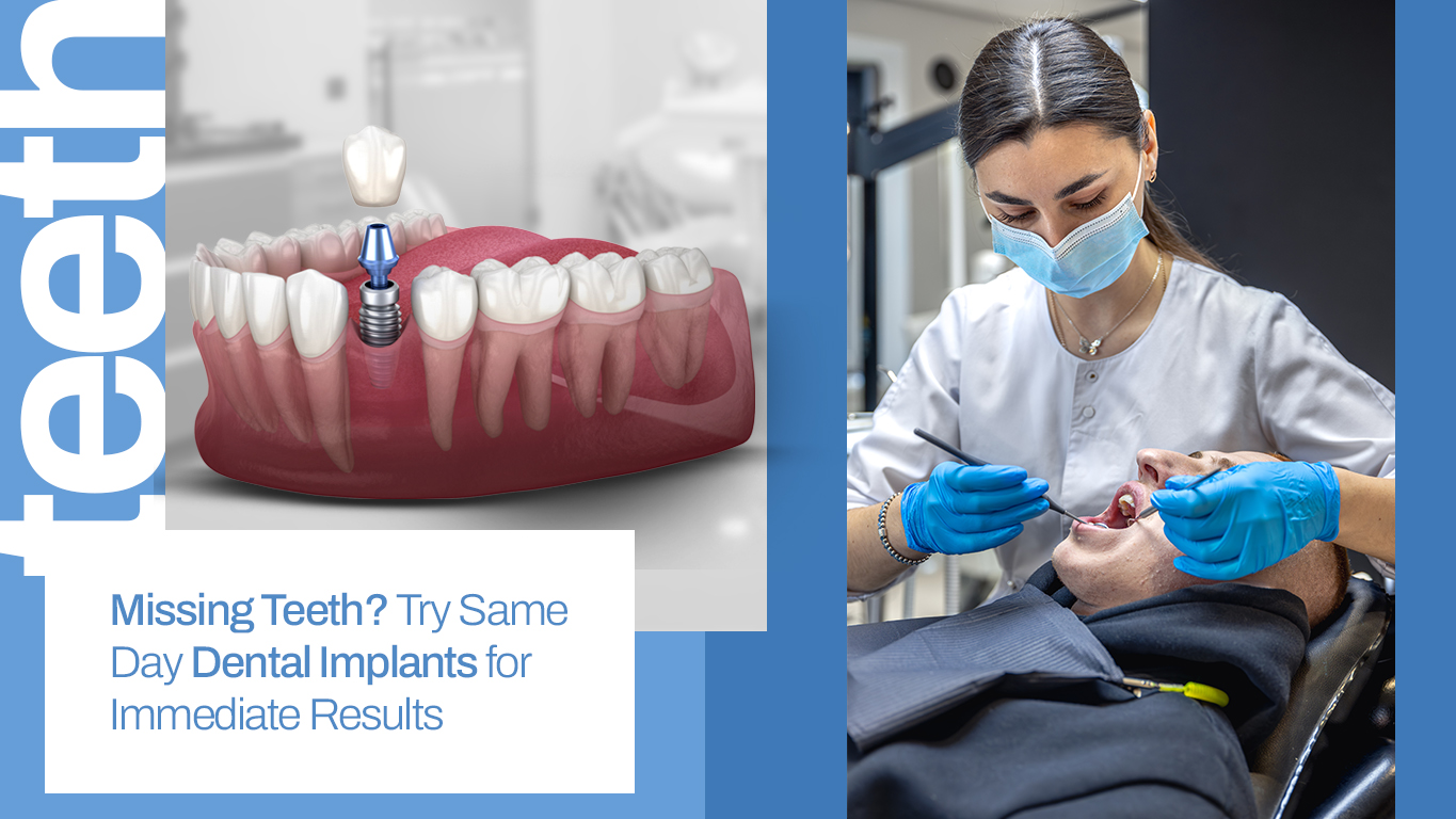 same day dental implants​