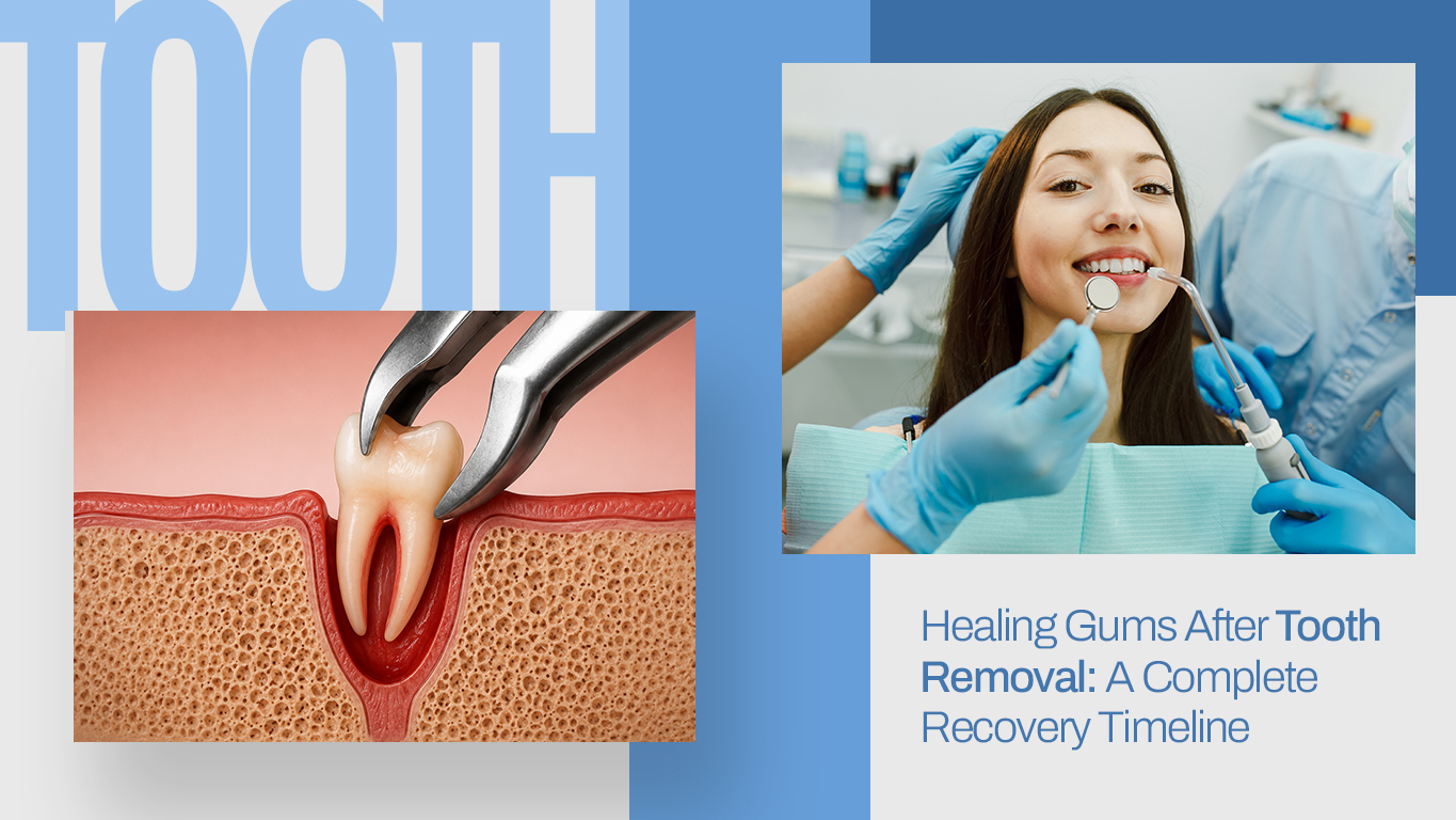 Healing Gums After Tooth Removal- A Complete Recovery Timeline