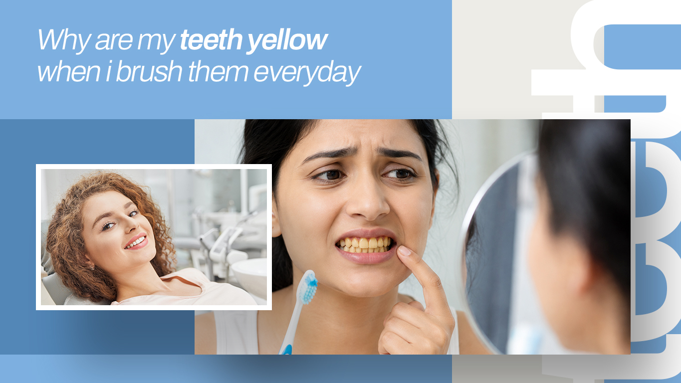 Why Are My Teeth Yellow When I Brush Them Every Day?