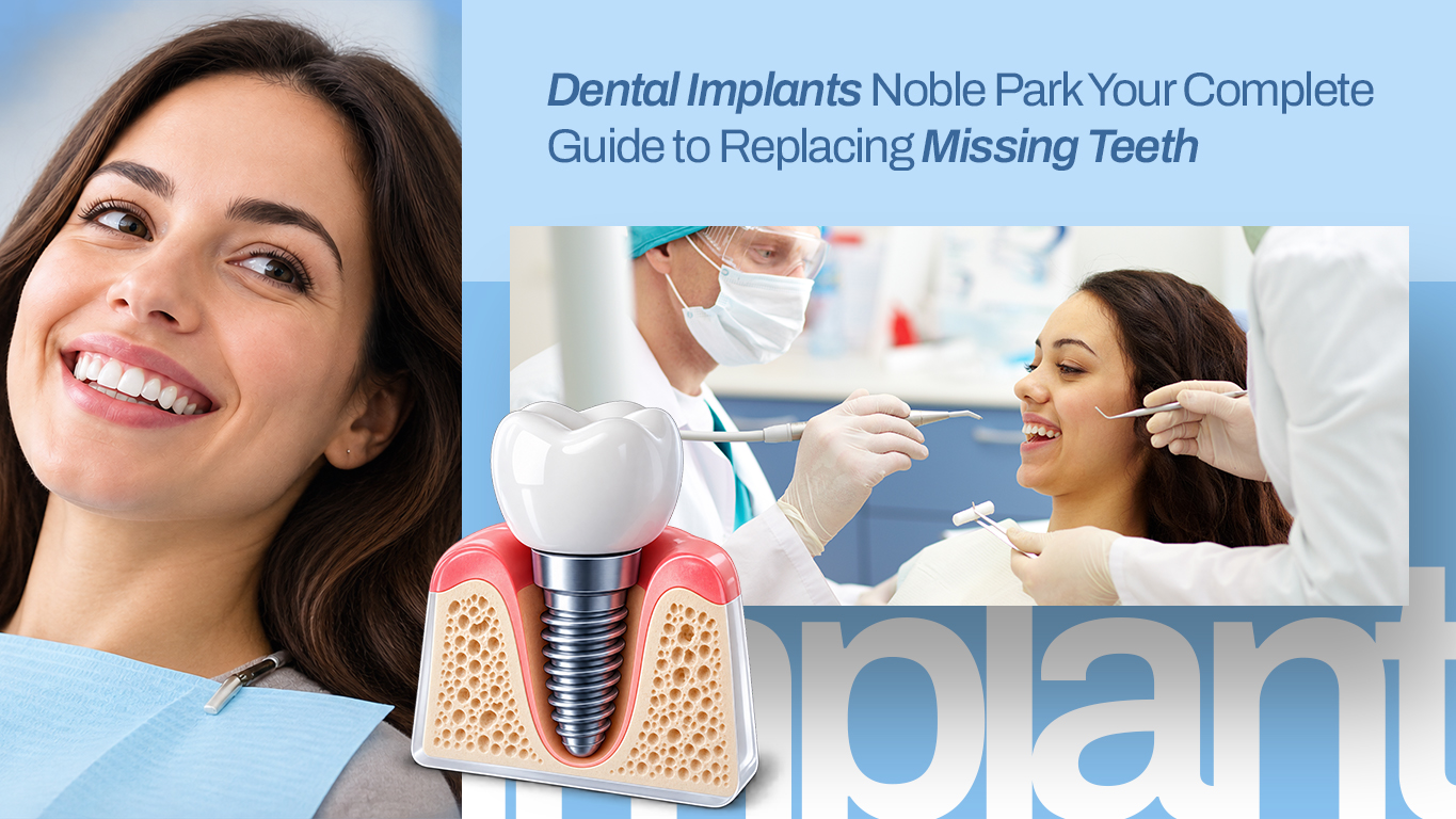 Dental Implants Noble Park