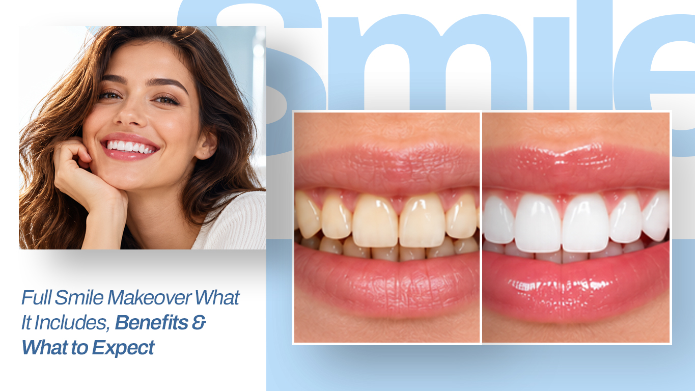 Full Smile Makeover Guide image