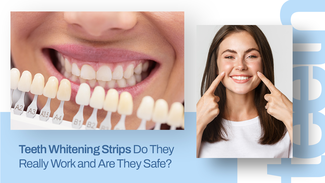 Blog image Teeth Whitening Strips Do They Really Work and Are They Safe