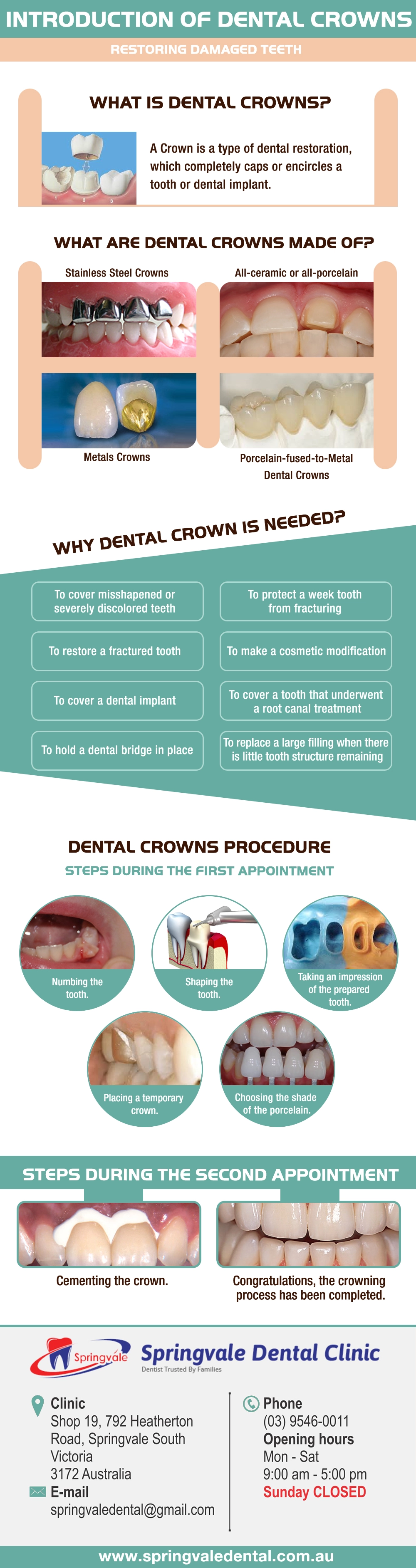 Introduction of Dental Crowns
