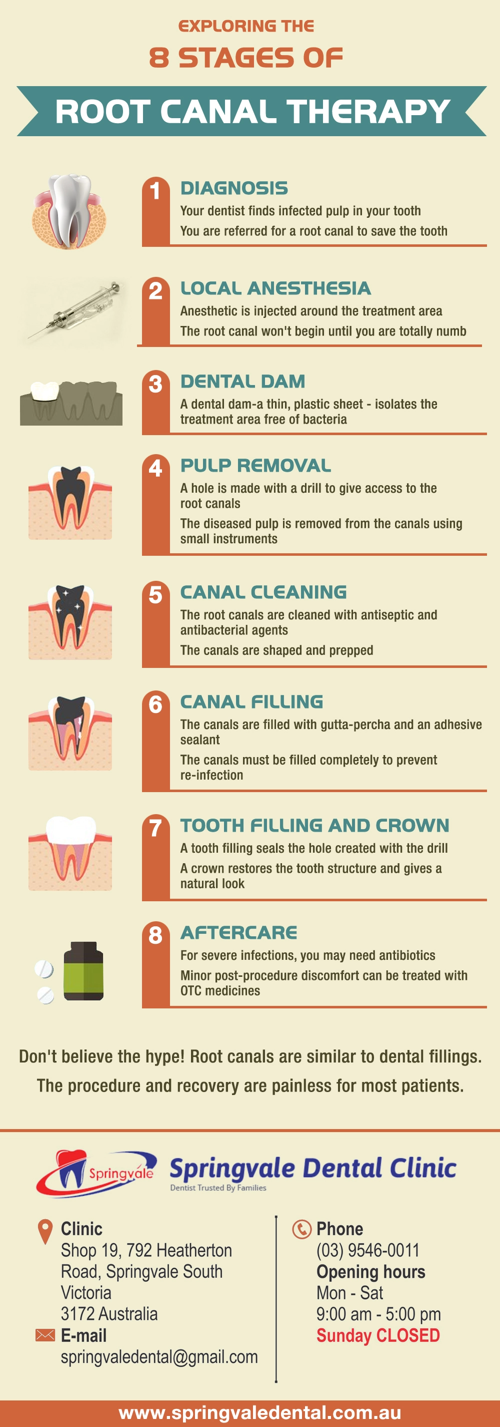 Exploring the 8 Stages of Root Canal Therapy